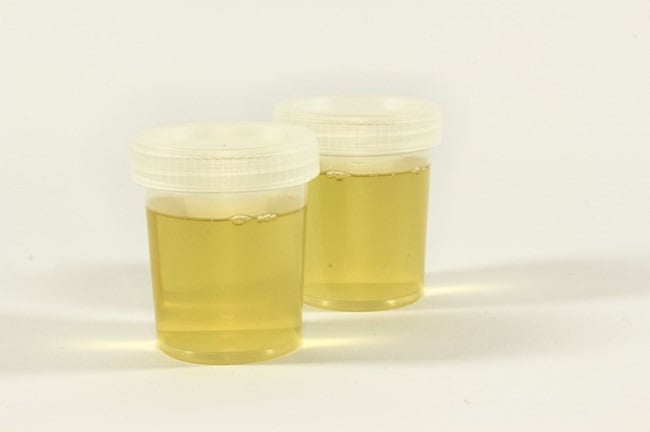 Because of the level of privacy required for a donor to produce a urine sample, it is possible for them to switch samples