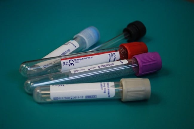 Blood drug testing is an invasive procedure